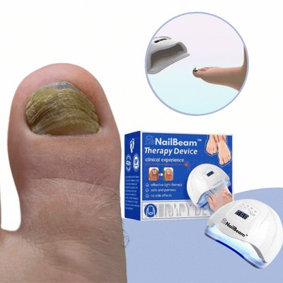 NailBeam™️ | Fjern neglesopp innen 7 dager!