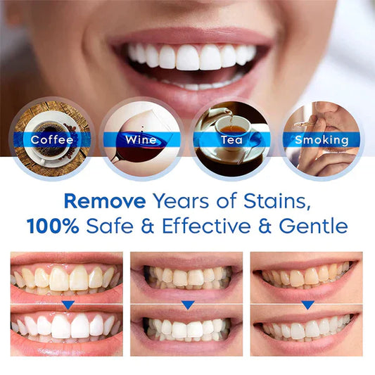 PerfectSmile™ Teeth Whitening Stick 1+1 GRATIS!