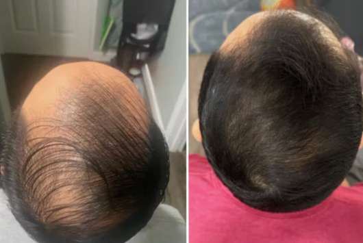 BIO-DENSYL® MULTIAKTIVT HÅRSERUM