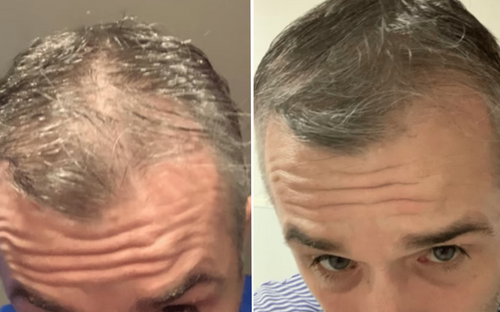 BIO-DENSYL® MULTIAKTIVT HÅRSERUM