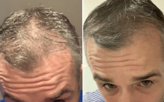 BIO-DENSYL® MULTIAKTIVT HÅRSERUM