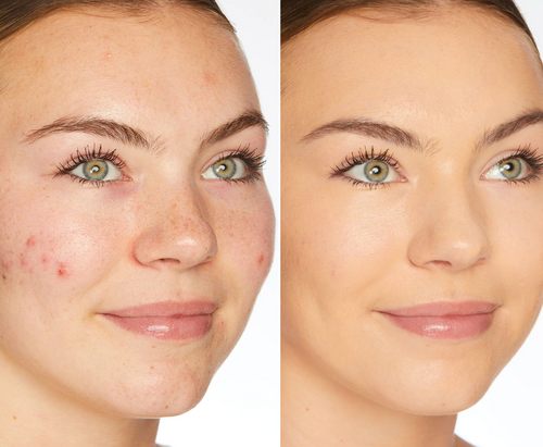 Veloras BB Blur Tinted Moisturizer SPF 30 - Färgad fuktkräm
