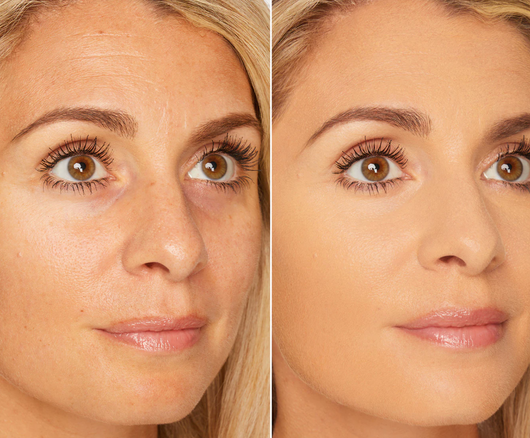 Veloras BB Blur Tinted Moisturizer SPF 30 - Färgad fuktkräm