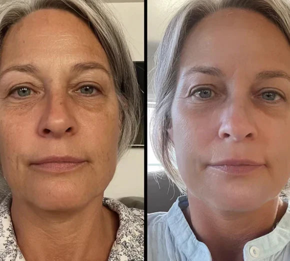 Dlaczego większość produktów anti-aging nie spełnia swoich obietnic