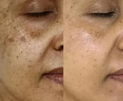 Velora PDRN Collagen Volume Balm