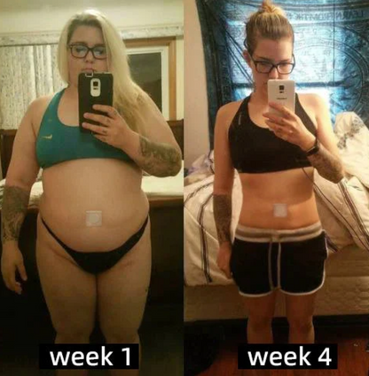 Apilift™ | Advanced Bee Venom Bantning Patch