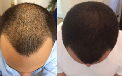 ROOT ACTIVATOR SHAMPOO | STIMULERER HÅRVEKSTEN