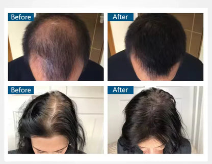 Toppik Hair Thickening – Für volleres, dichteres und gesünder aussehendes Haar in Sekundenschnelle!