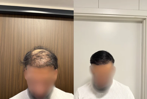Nova™ Hairfillup  Naturlig Utseende og Vannavstøtende Beskyttelse