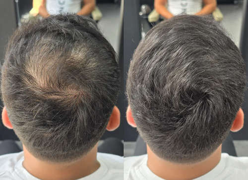Nova™ Hairfillup  Naturlig Utseende og Vannavstøtende Beskyttelse