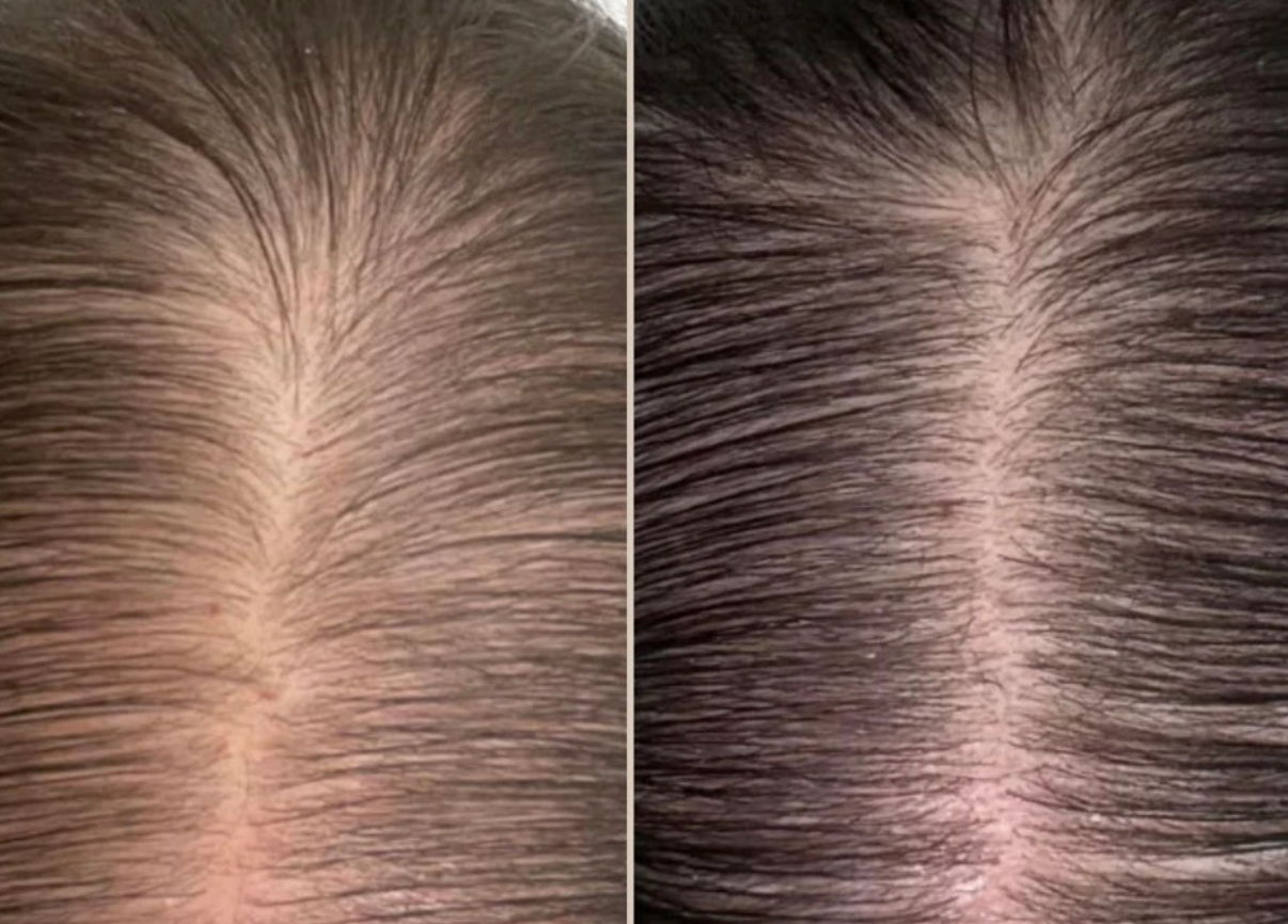 Bli av med grått hår på sekunder - Synlig återväxt. Äkta självförtroende!